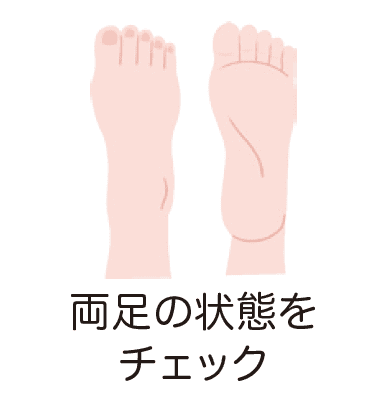 イラスト:両足の状態を定期的にチェックする