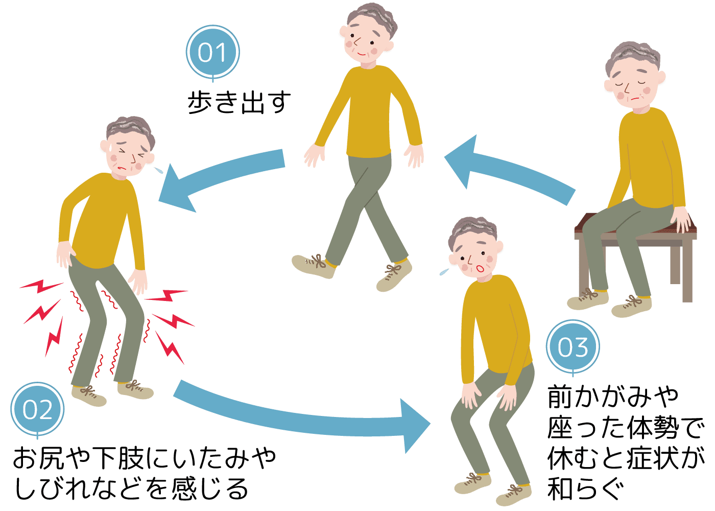 神経性間欠跛行の図解。1歩き出す、2お尻や下肢にいたみやしびれを感じる、3前かがみや座った体勢で休むと症状が和らぐ